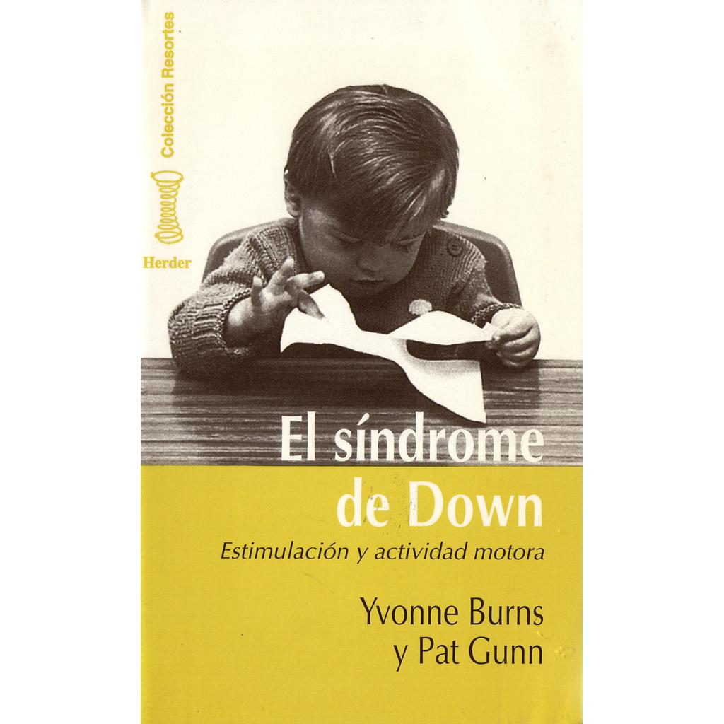SINDROME DE DOWN